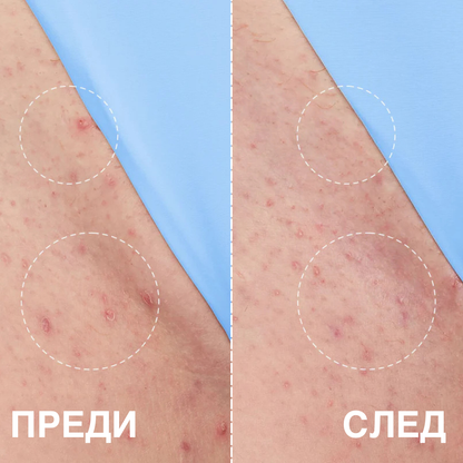DEROLI™ - Smoothing solution (Серум срещу враснали косми)